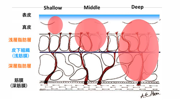 ザーフ(XERF)の効果予測図